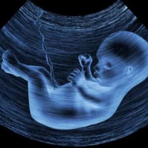 Researchers Found Microplastics In The Placentas Of Unborn Babies